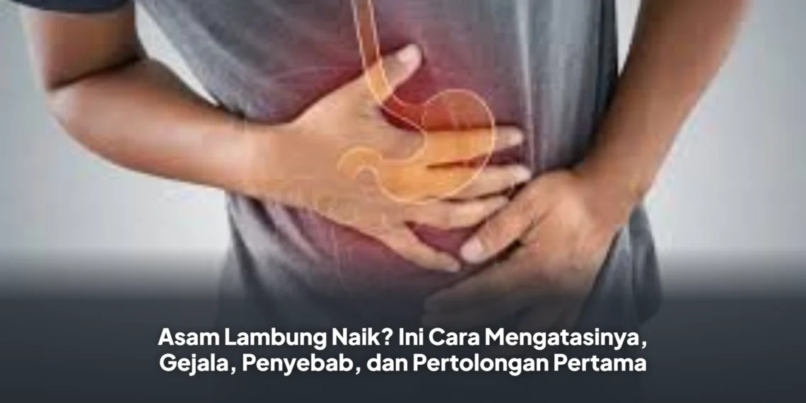 Asam Lambung Naik? Ini Cara Mengatasinya, Gejala, Penyebab, dan Pertolongan Pertama